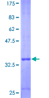 12.5% SDS-PAGE Stained with Coomassie Blue.